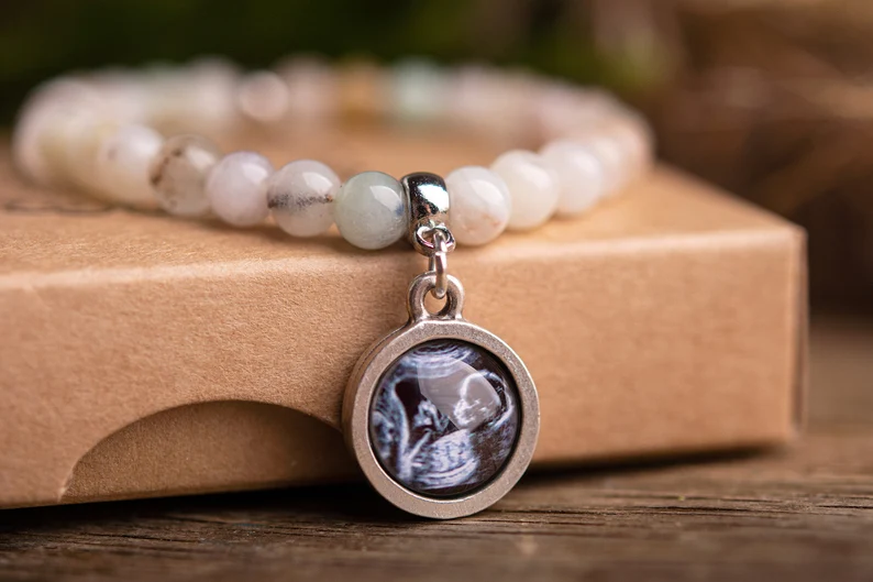 Custom ultrasound photo bracelet